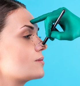 Blog 6 Rhinoplasty Surgery